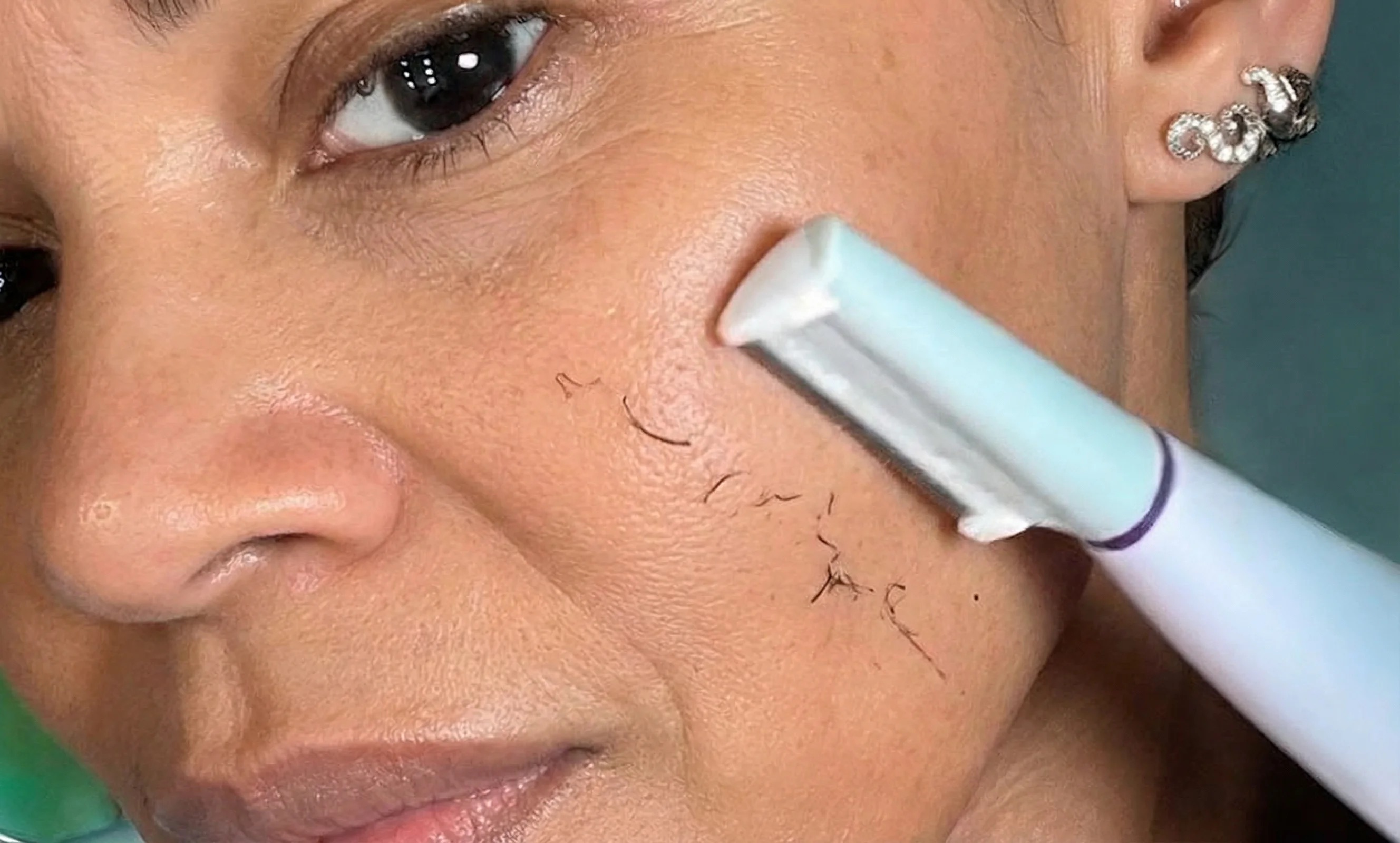 Sonicsmooth Pro+ spa-like facial treatment