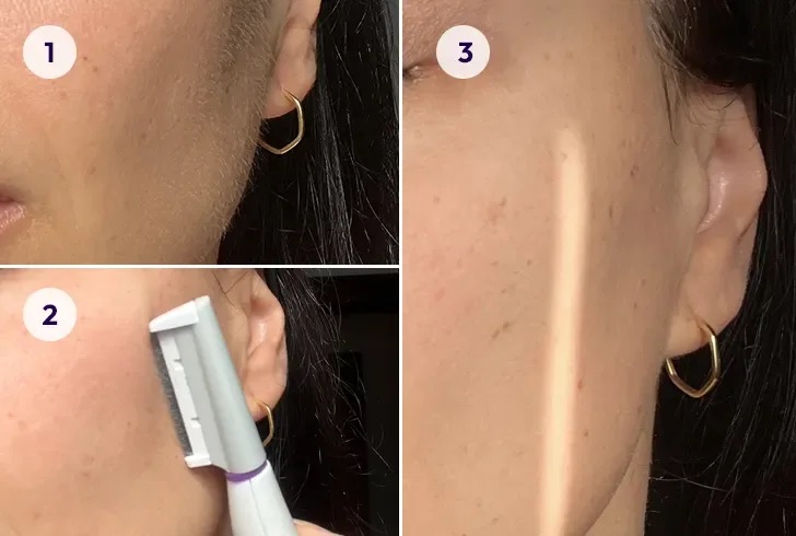 Ready to transform your skin